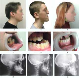 Классификация дефектов