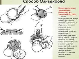 Описание процесса, техника выполнения