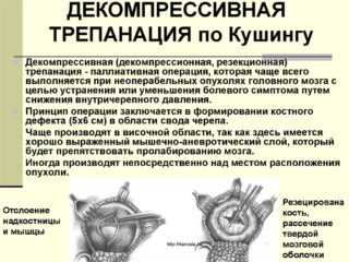 Подготовка к трепанации