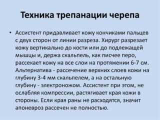 Трепанация черепа: что это такое, последствия, показания, инструменты для операции, виды, восстановление