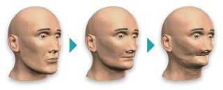 Виды дефектов челюстей: классификация аномалий и их определение, причины деформаций