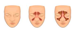 Виды дефектов челюстей: классификация аномалий и их определение, причины деформаций